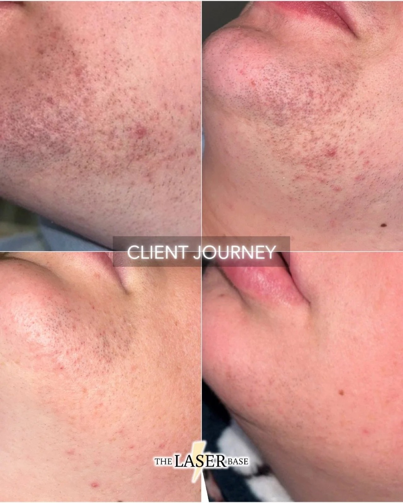 Face result