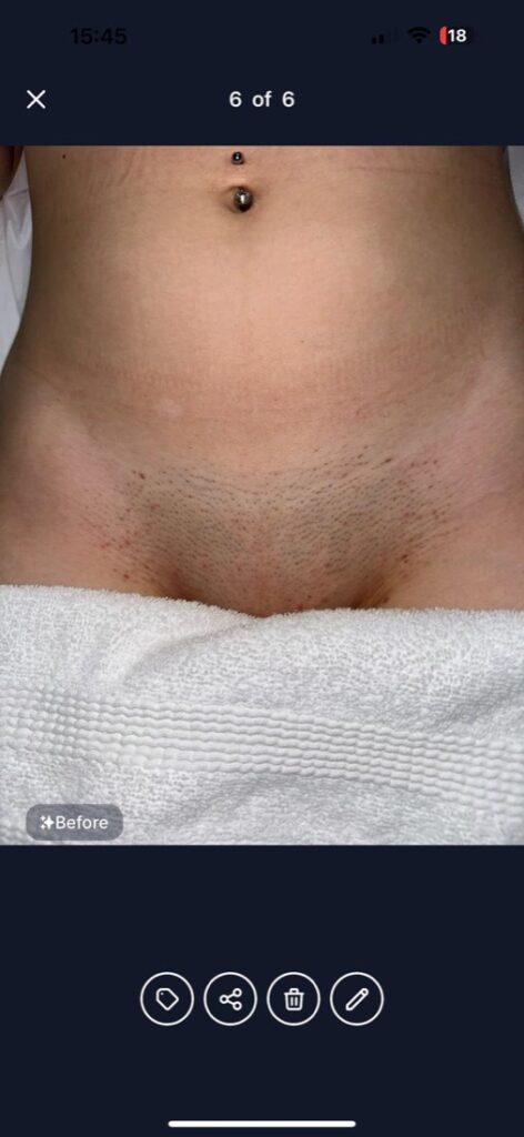 Before