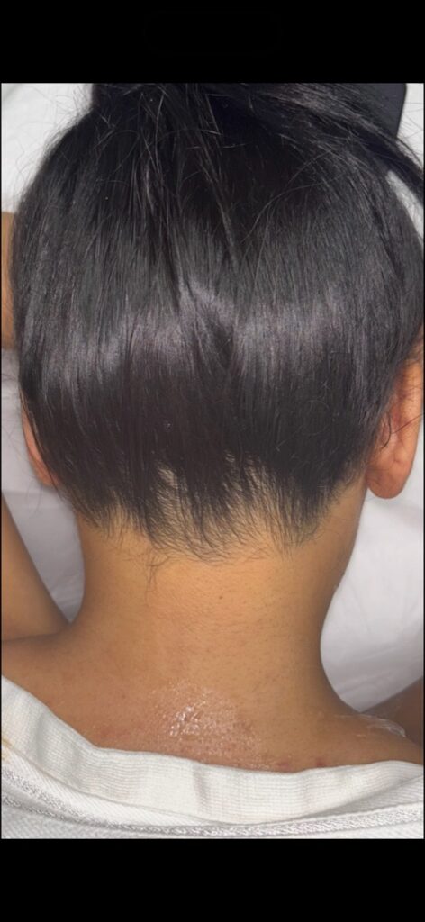 After