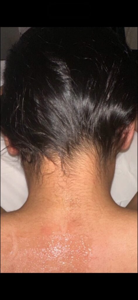 Before