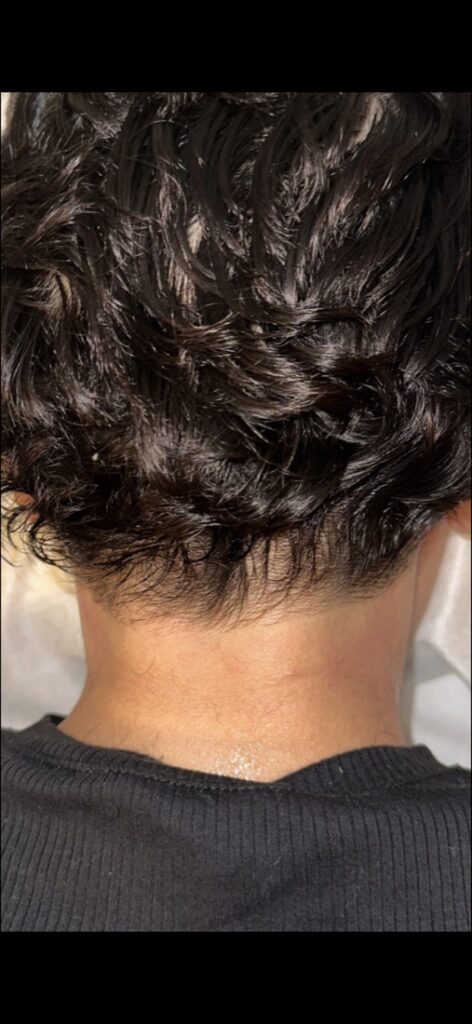 After
