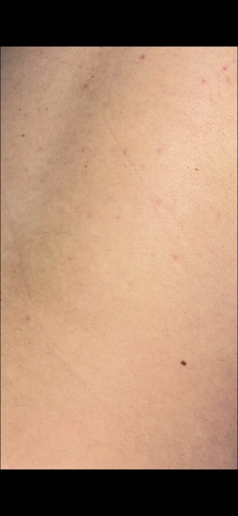 After