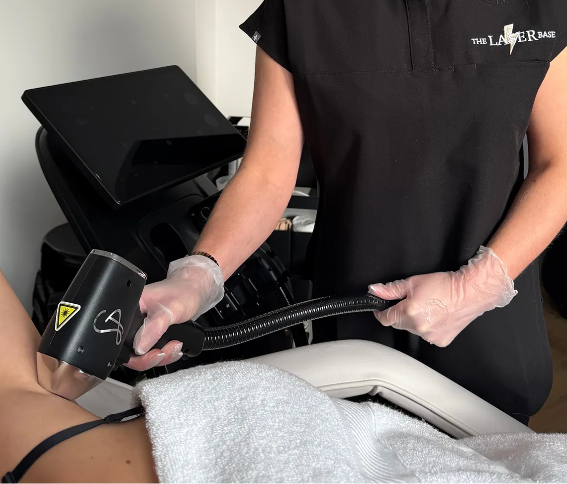 Laser hair removal treatment at The Laser Base