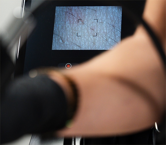 Skin analysis scanner during a consultation