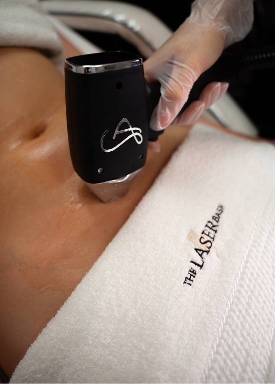 Intimate laser hair removal treatment at The Laser Base
